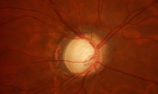 Fundus