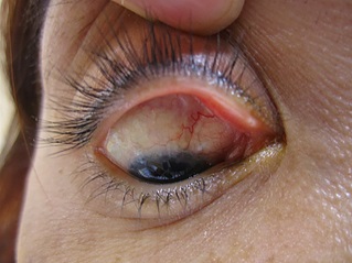 Fundus