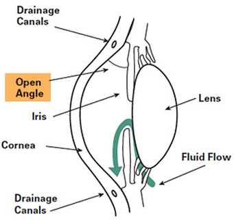 Open Angle