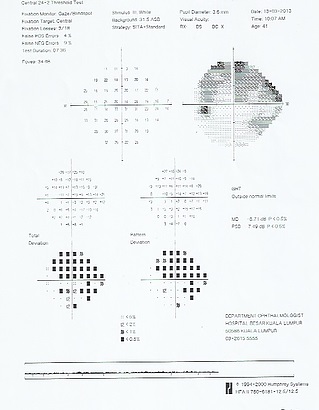 Fundus